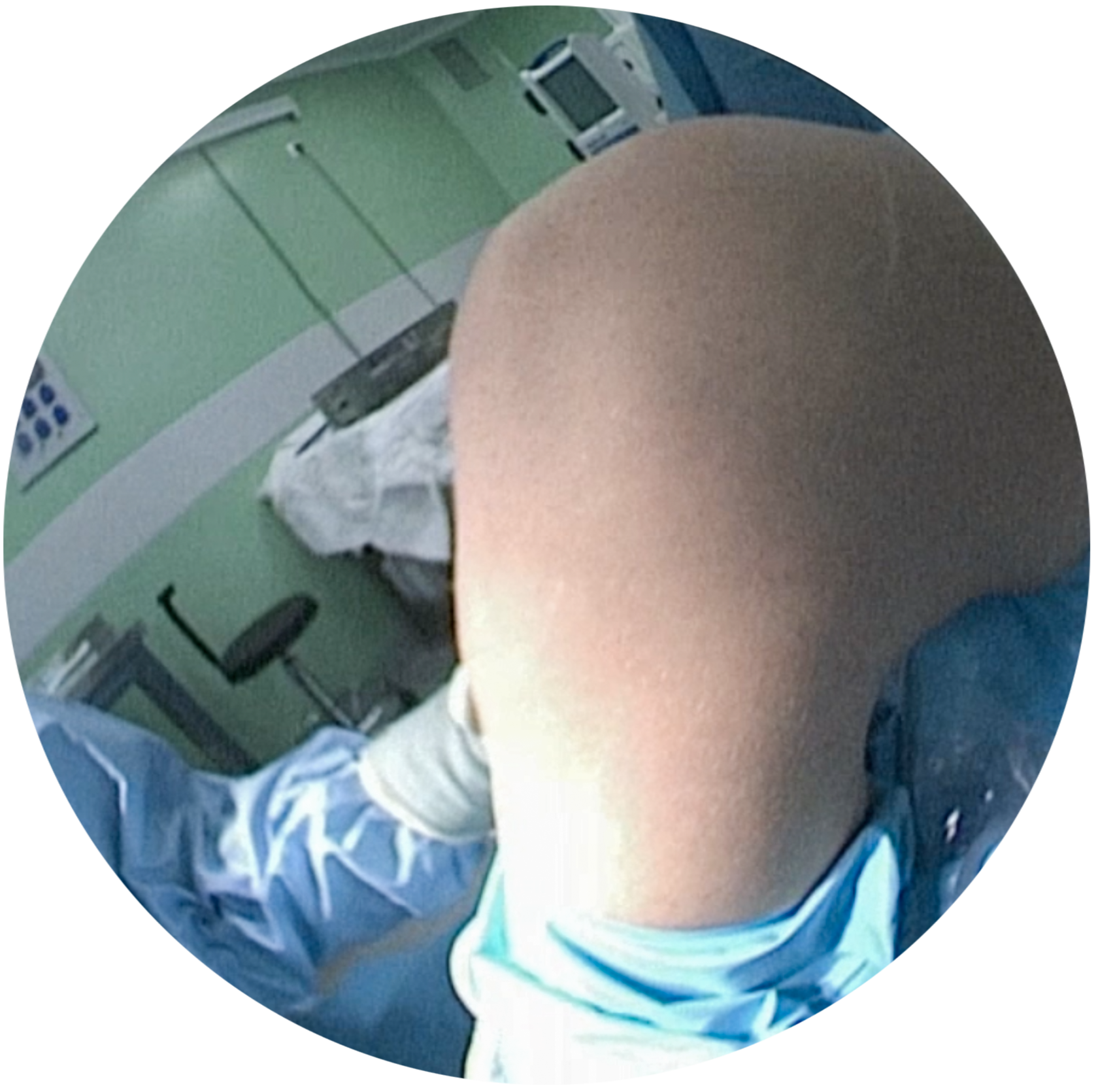 Arthroscopy. Injuries of the knee and shoulder joints.