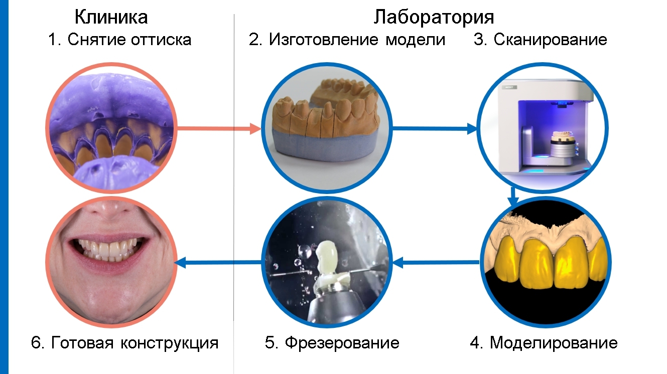 CAD/CAM технологии в стоматологии