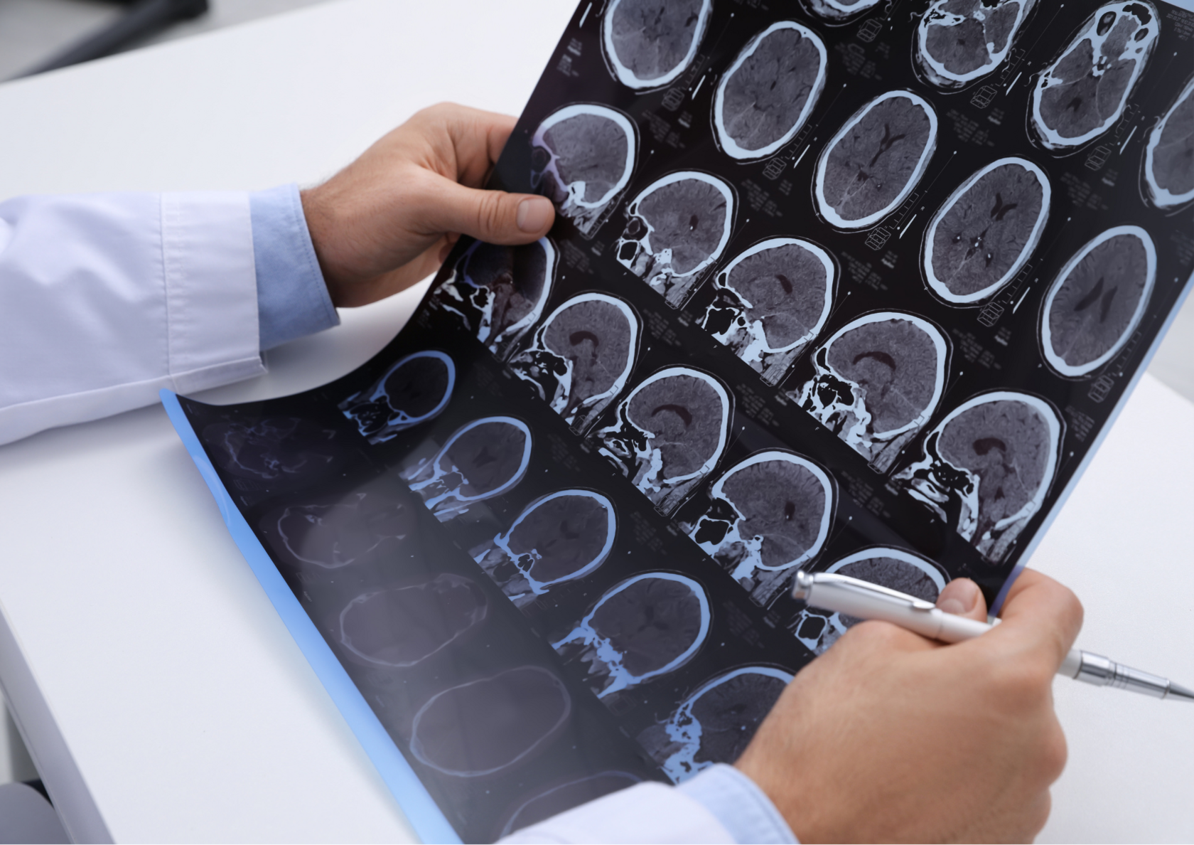 Група інвалідності при розсіяному склерозі