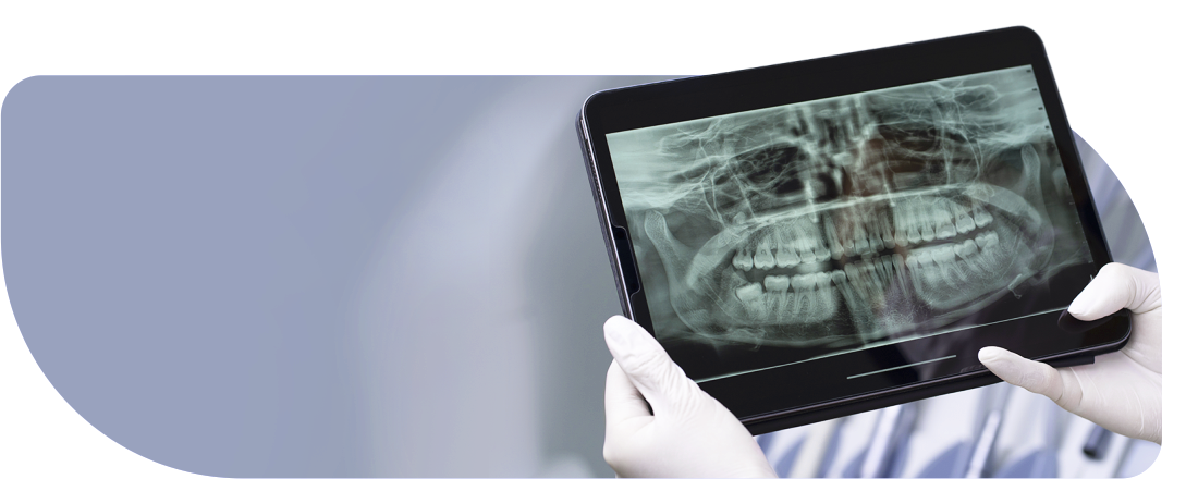 Он лайн консультация стоматолога по снимку КТ