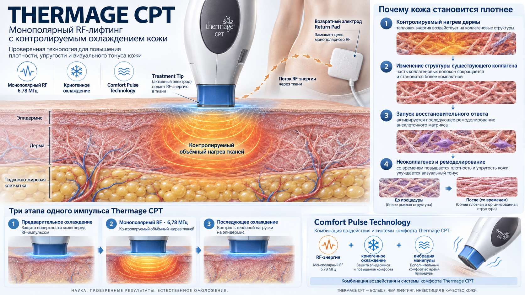 Thermage CPT: монополярный RF 6,78 МГц, Return Pad, охлаждение и ремоделирование коллагена