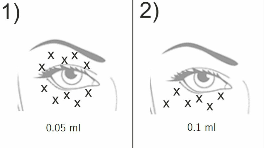 Схема введения препарата Meso Eye C71