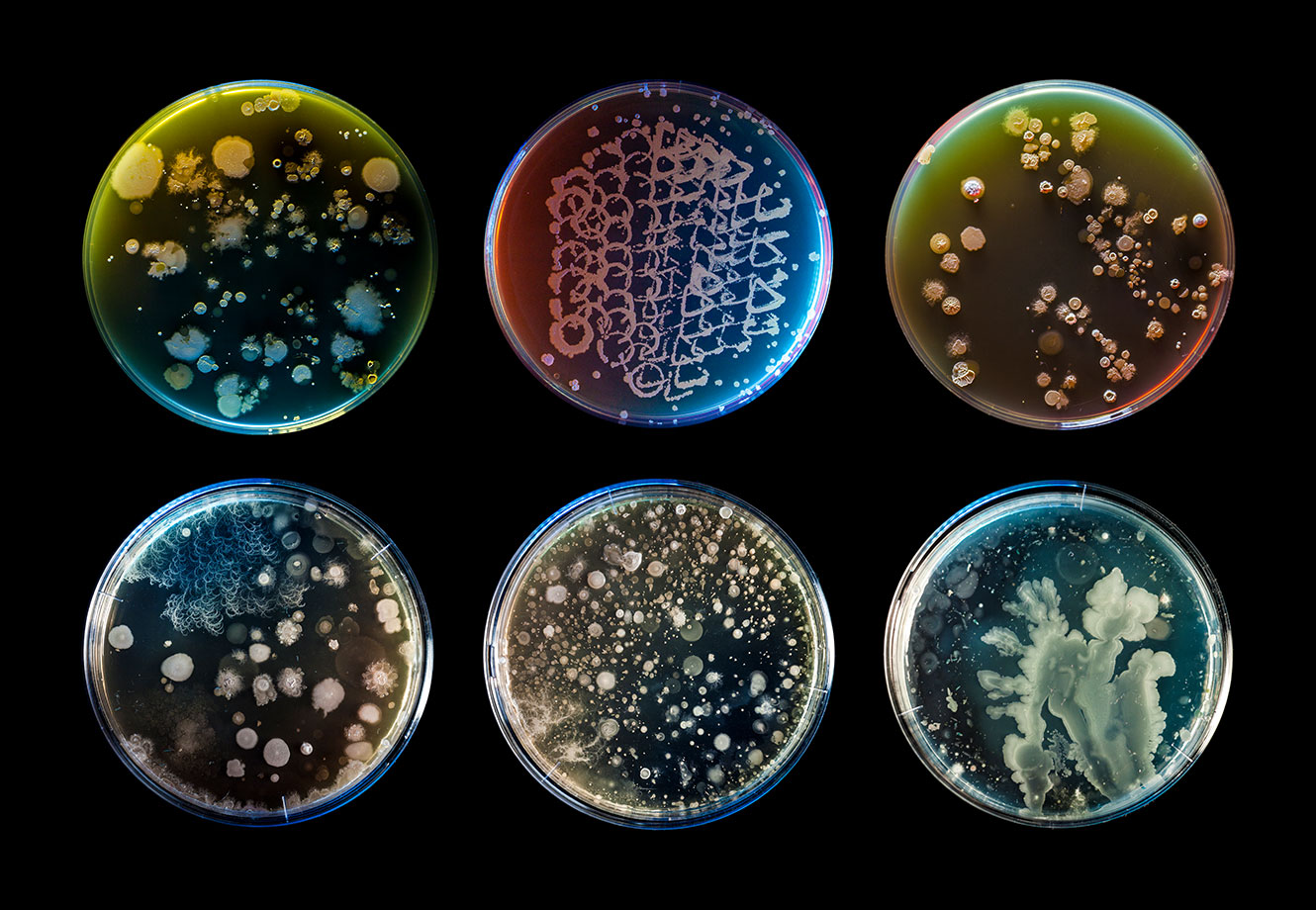 Культивирование клеток человека на питательных средах. Бактерия Cupriavidus necator. Питательные среды в биотехнологии. Биотехнология микроорганизмов. Питательная среда для бактерий.