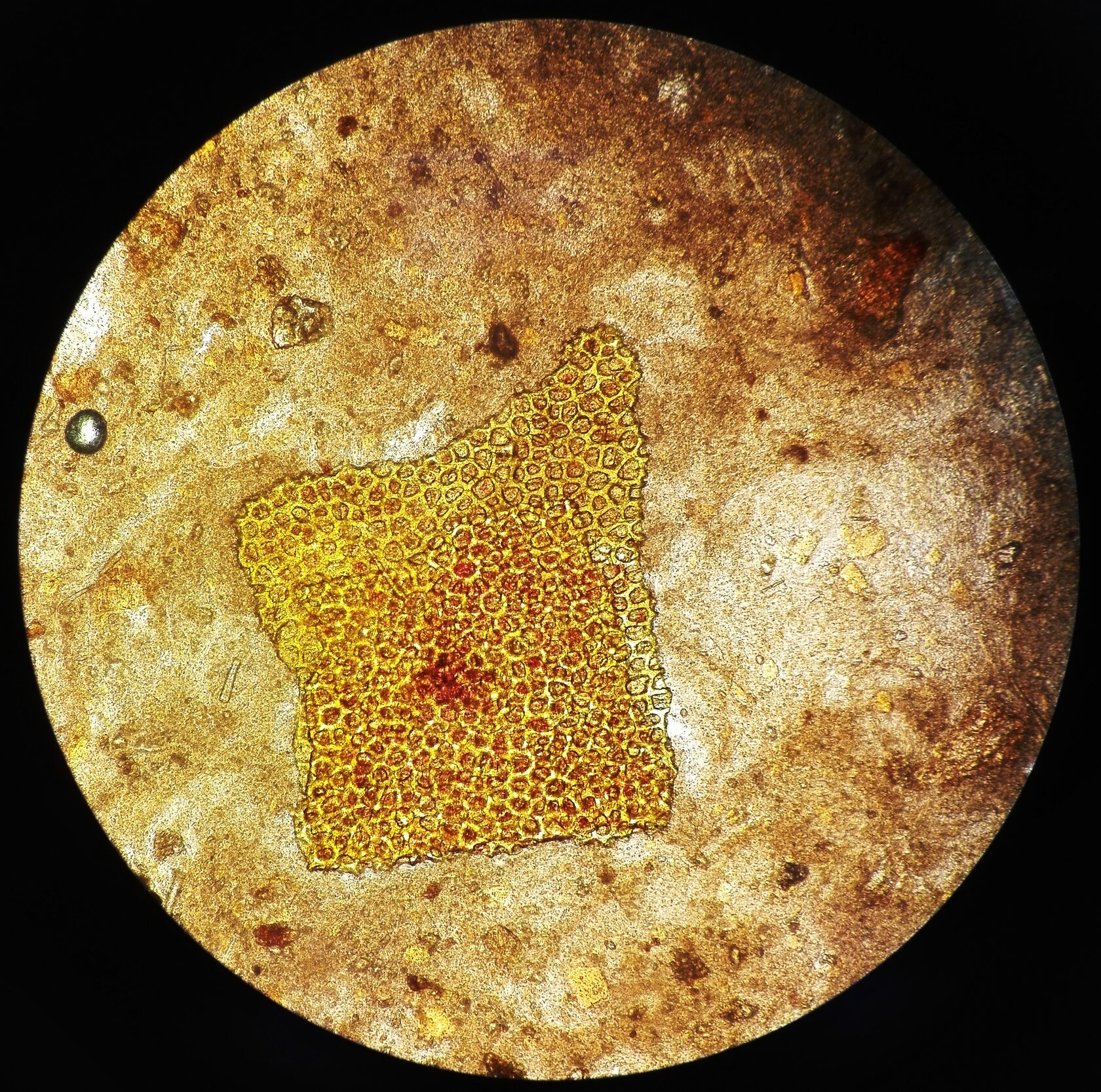 Микроскопия кала растительная клетчатка