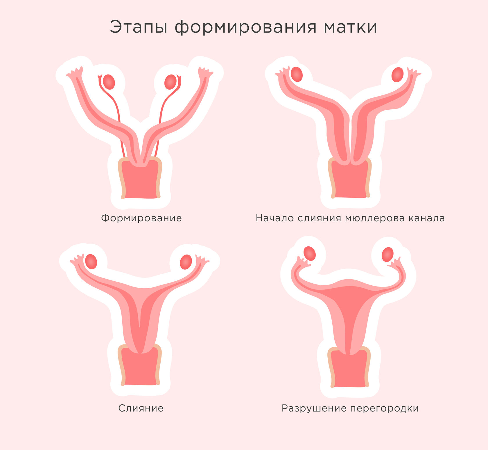Патологии матки: как с ними забеременеть и родить?