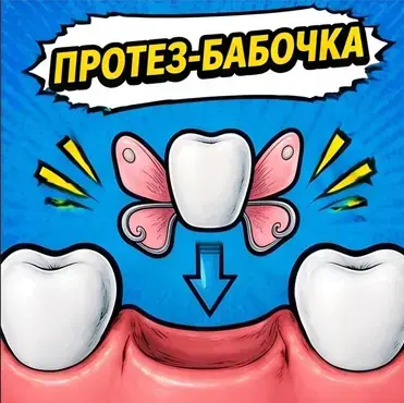 Протез-бабочка