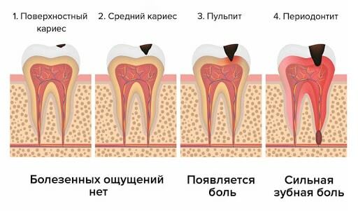 Как быстро избавиться от зубной боли