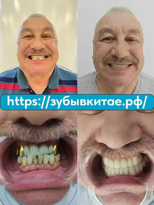 До и после — кейс 17