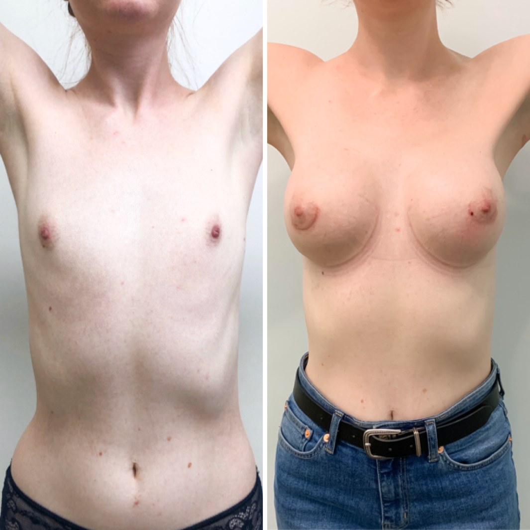 голая на операции фото до и после фото 14