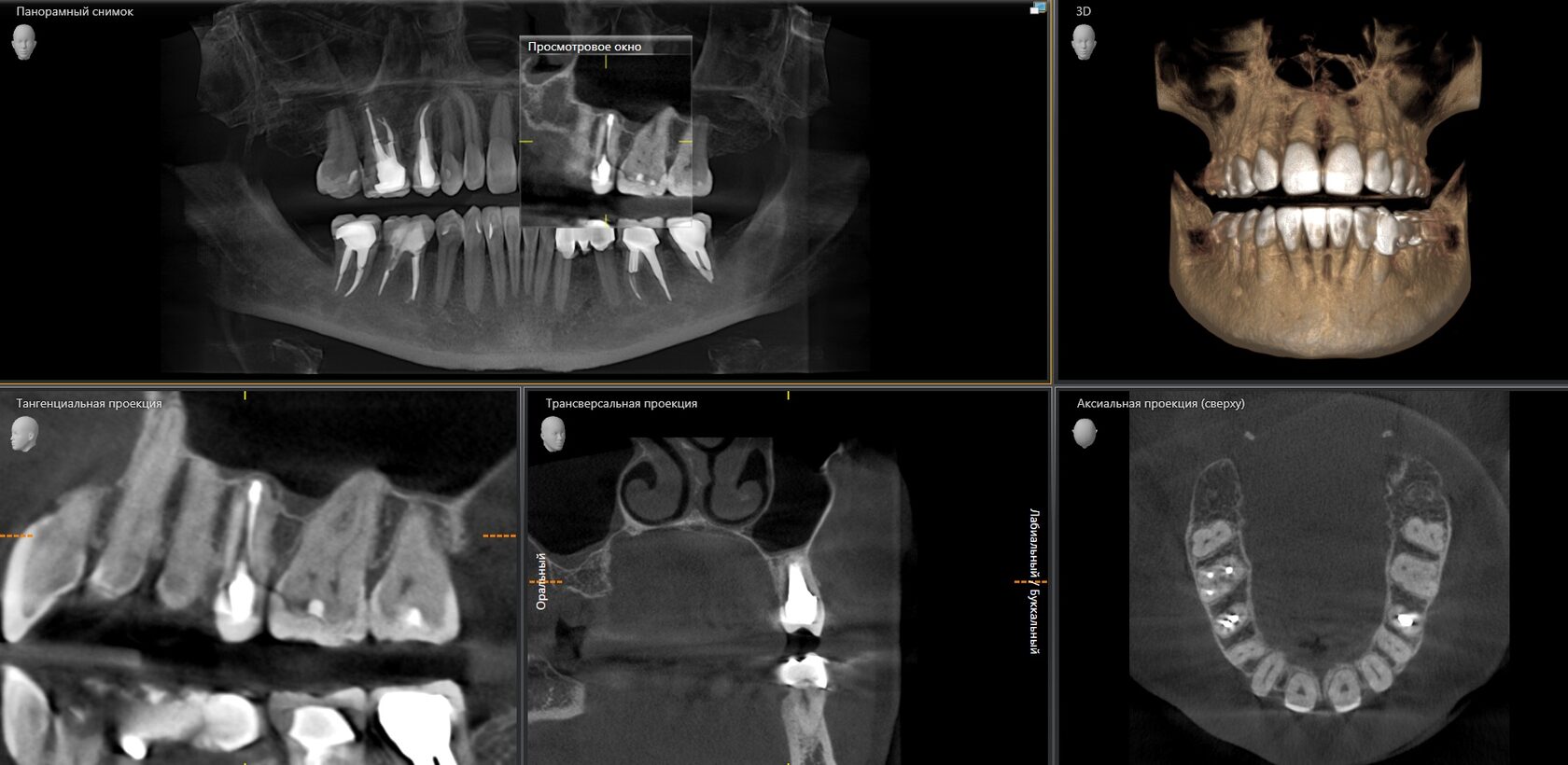Компьютерная томография зубов в Москве по доступным ценам