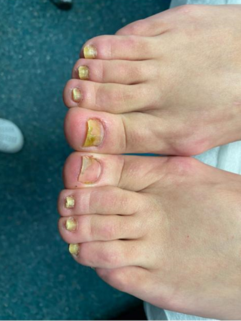 Профессиональный педикюр