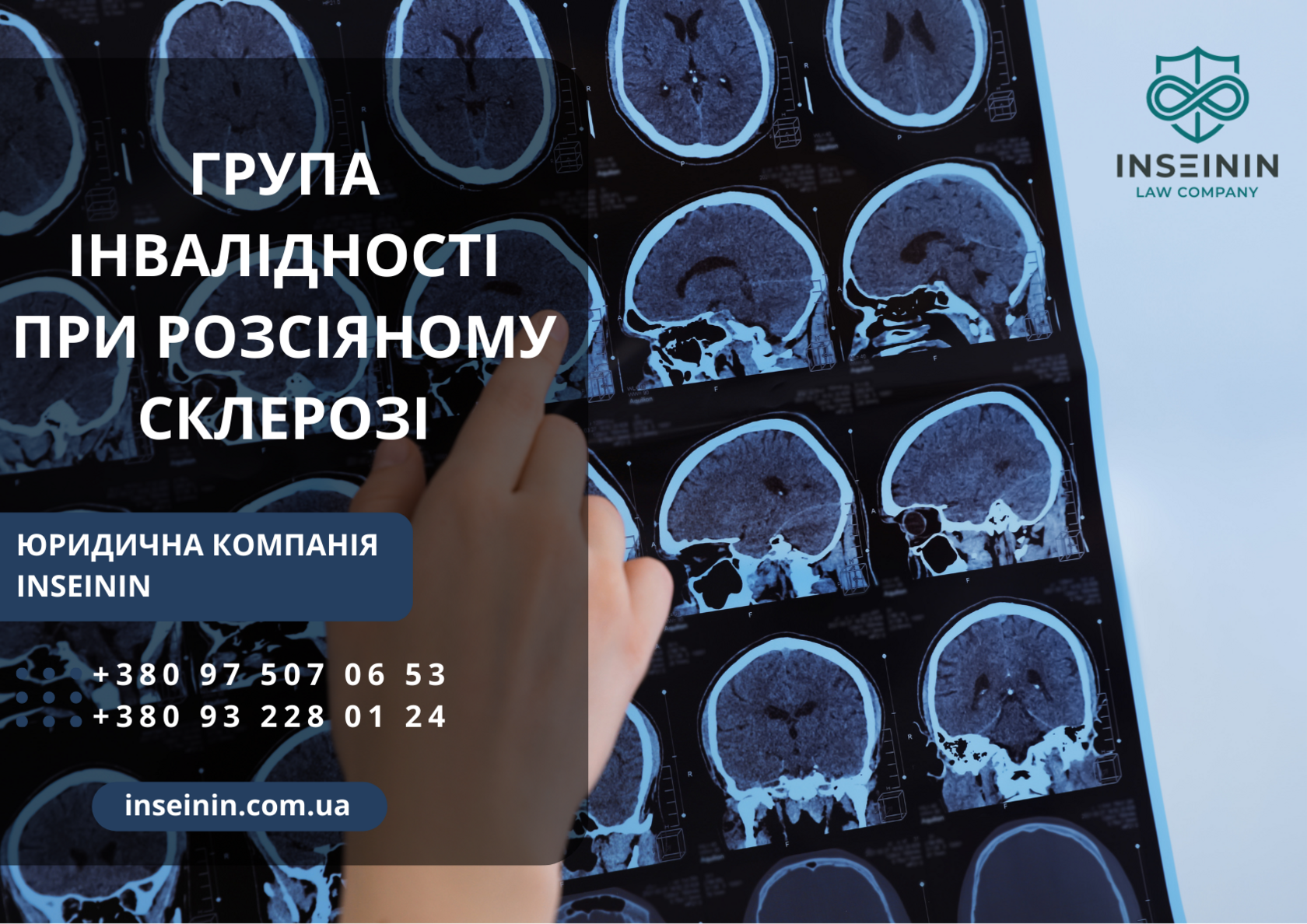 Група інвалідності при розсіяному склерозі