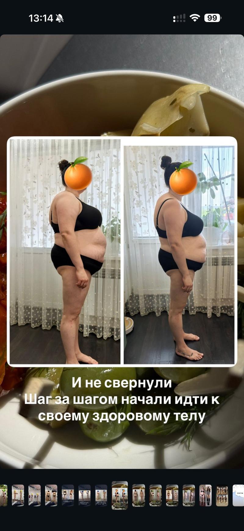 До и после ХМРЗ