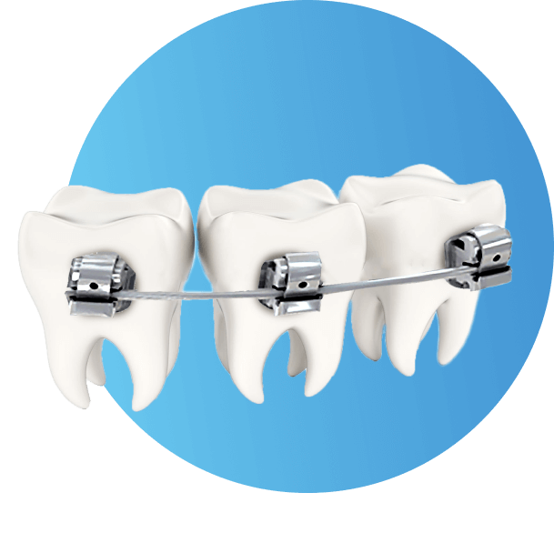 Ортодонтия