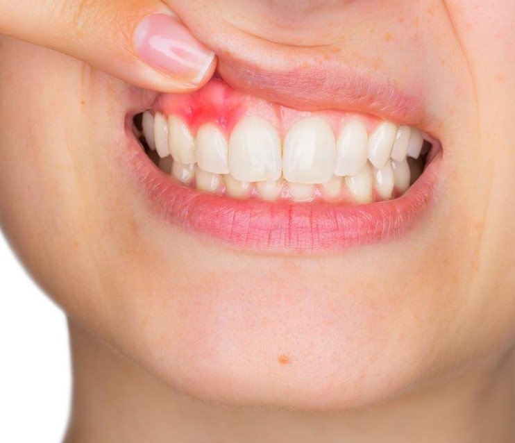 Гнилой зуб у ребенка – что делать?