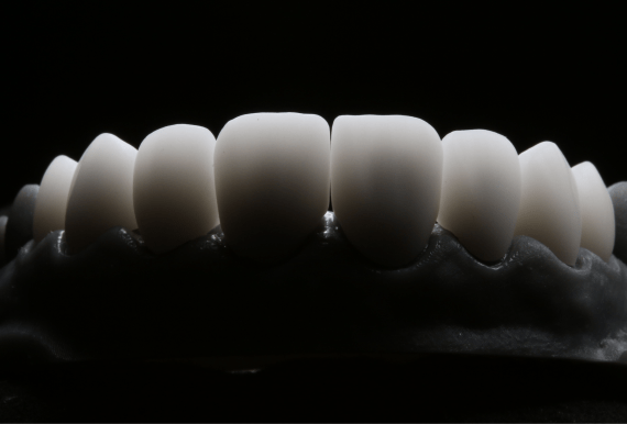 3D-планирование операции All-on-4 для точной установки имплантов в Москве