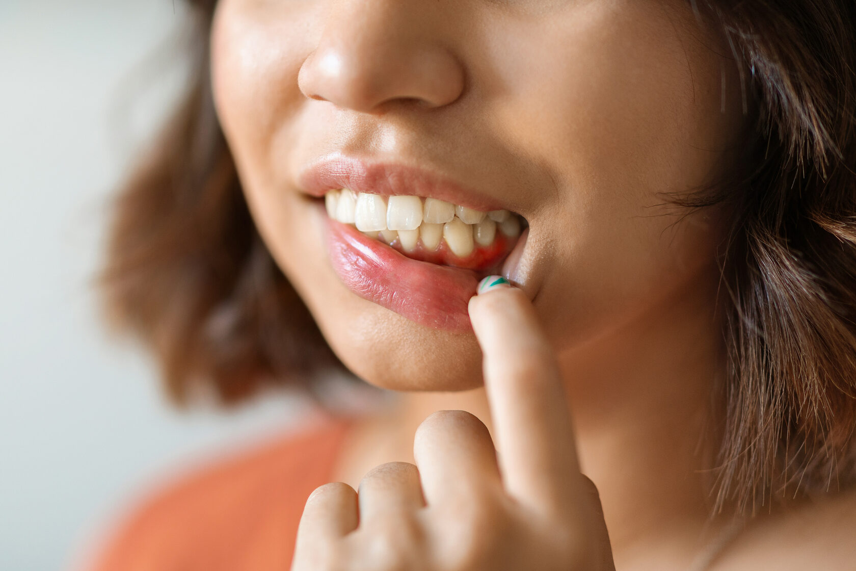 Чем лечить воспаление десен у взрослых – стоматология ПрезиДЕНТ
