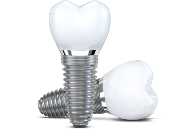 протезирование зубов в сургуте виды и цены