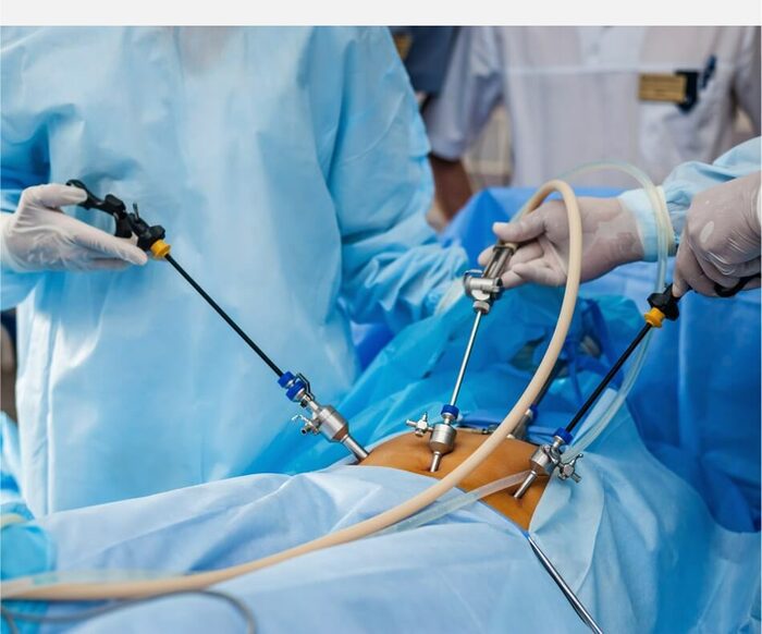 световая пломба по полису омс. пломбирование зубов световой пломбой. световая пломба по полису омс. световая пломба материал. световые пломбы стоматологические.