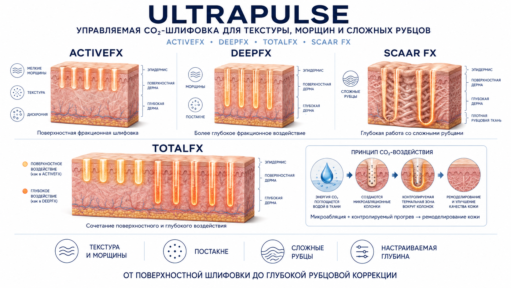 UltraPulse Encore: ActiveFX, DeepFX, TotalFX и SCAAR FX