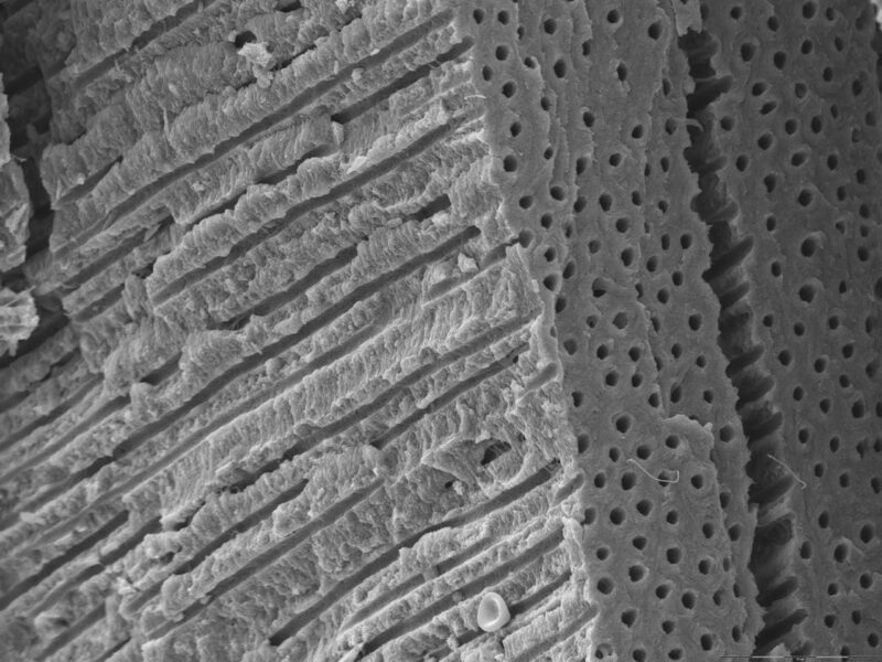 Дентин зуба в микроскоп