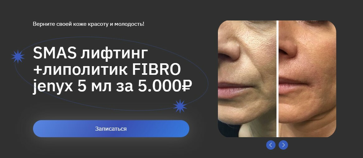 SMAS лифтинг +липолитик за 12990