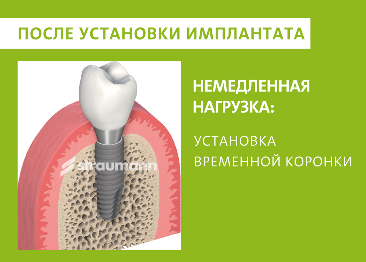 Фото имплант сразу после установки