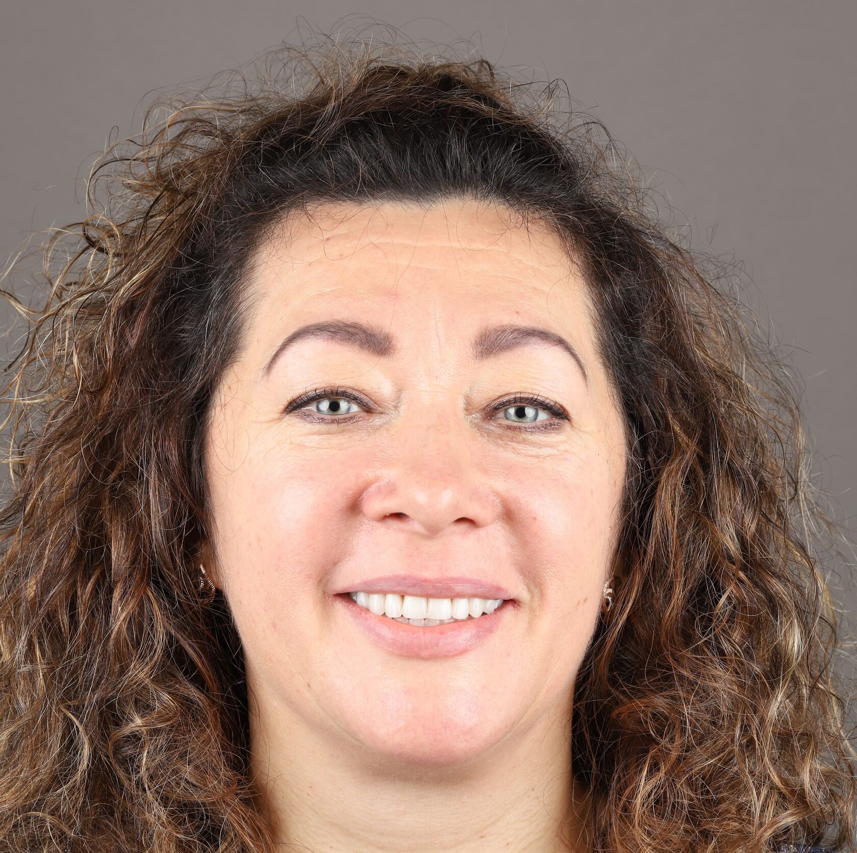 All-on-4, All-in-4 имплантация, протезирование, вернуть зубы, протезирование на имплантах, всё-на-4, все-на-четырех, протезирование зубов