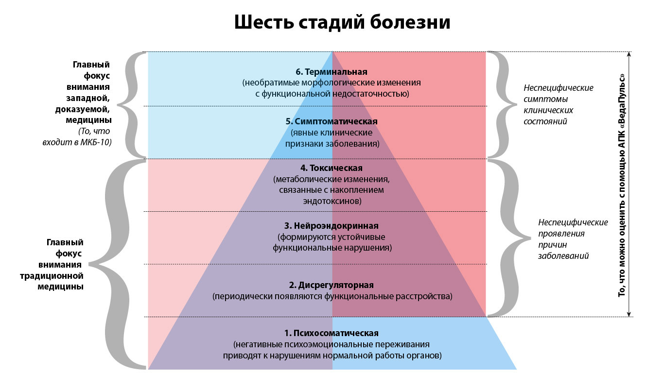 Дистанционный тренинг -EQ