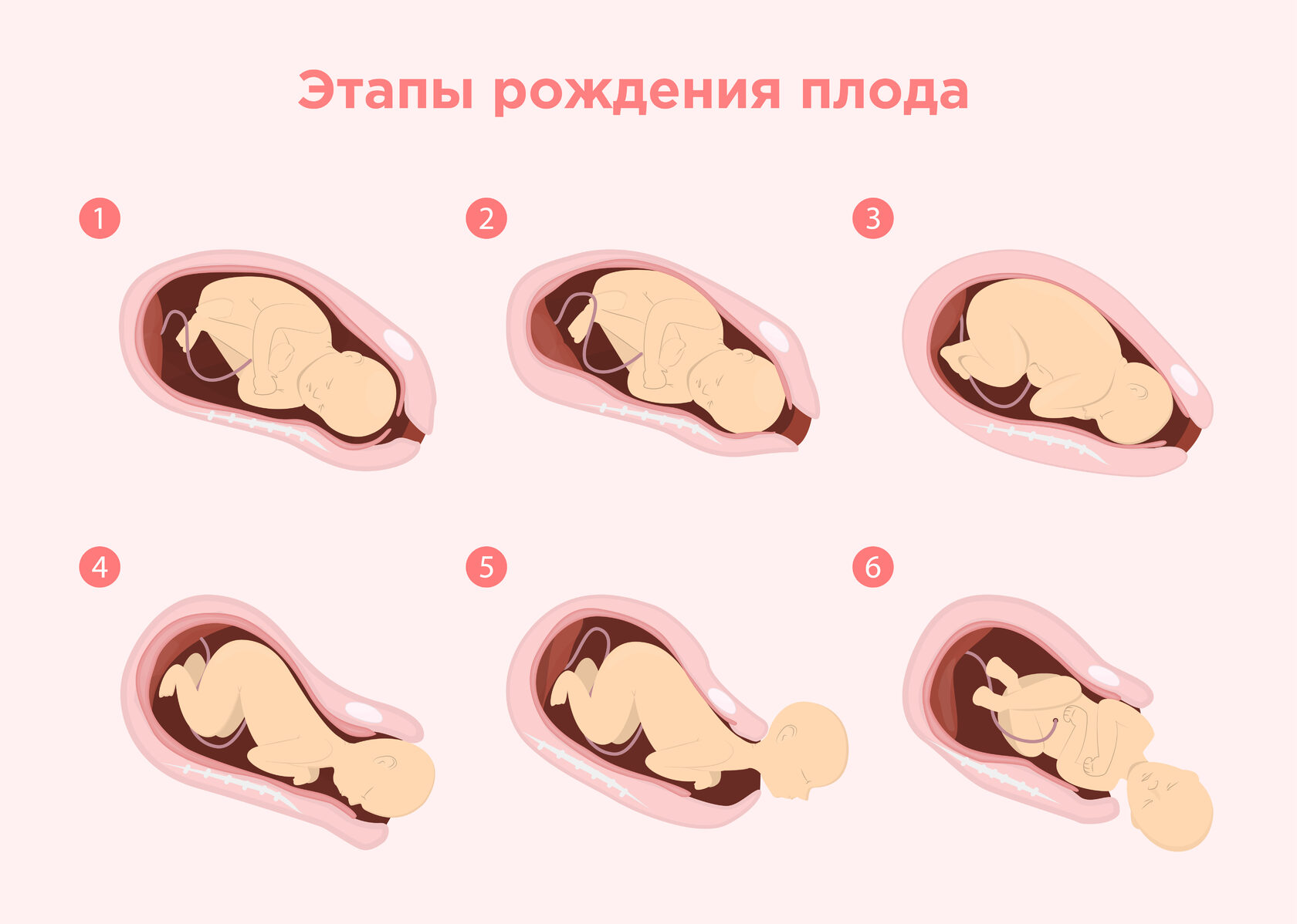 Как формируется головка ребенка после рождения