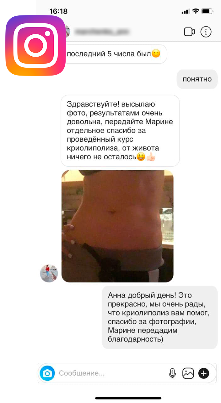 Криолиполиз в Москве - избавление от лишнего веса уже после 1 сеанса!