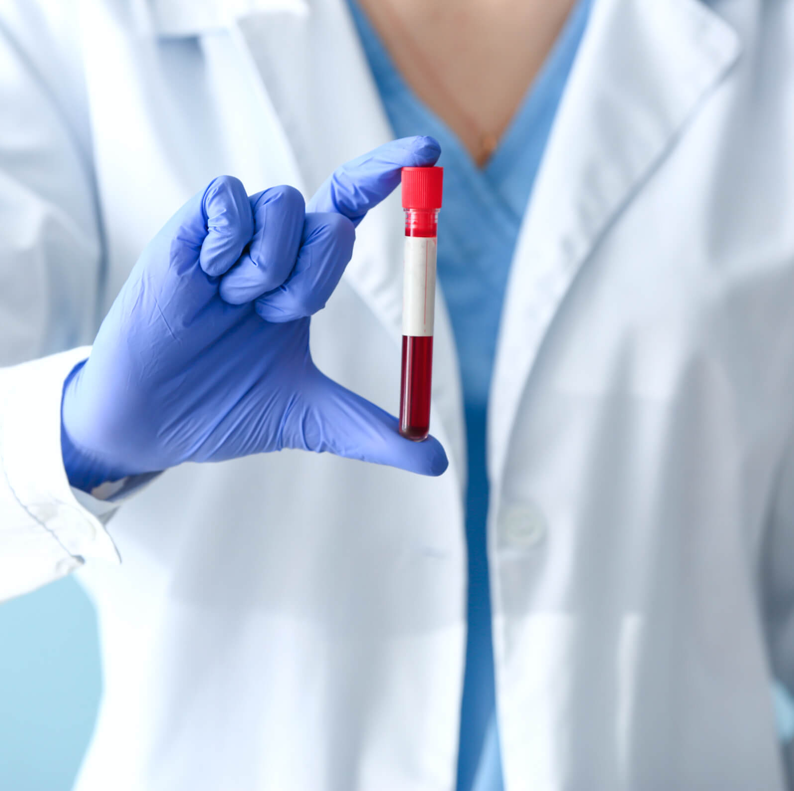 онкомаркер CYFRA 21-1