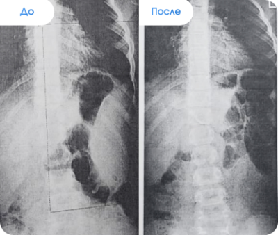 Результат До и После 2