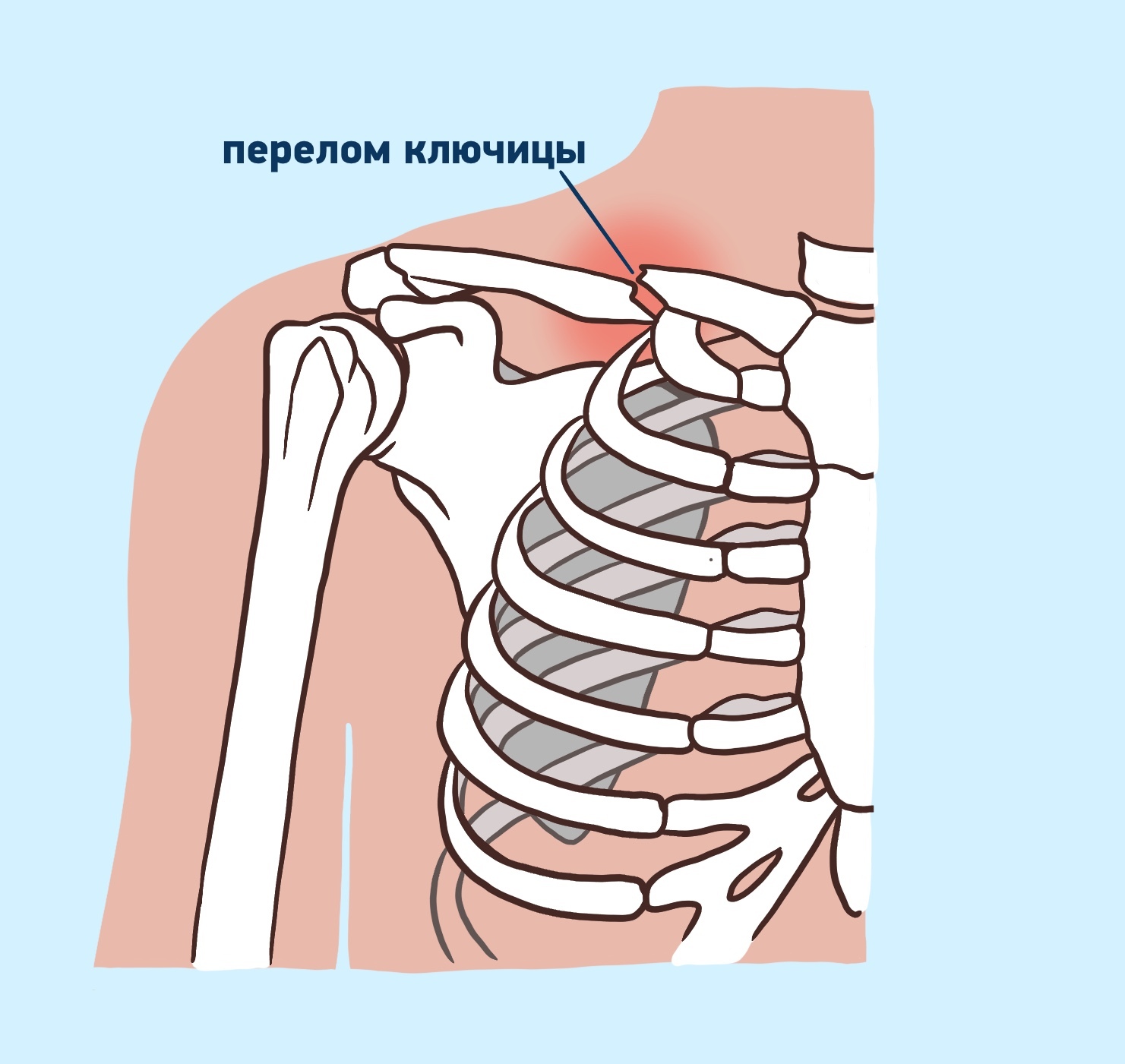 Прилипшие лопатки у малыша: миф или правда?