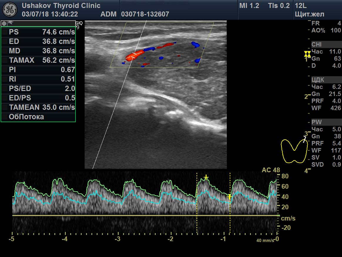 Клинический «ПРОТОКОЛ УЗИ ЩЖ» №10