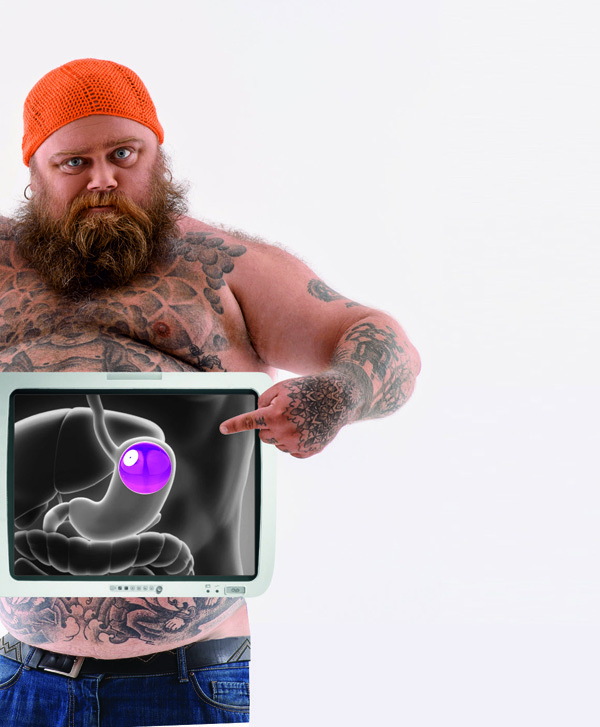 Пухлый человек за рентгеновским экраном, на котором виден установленный баллон в его желудке