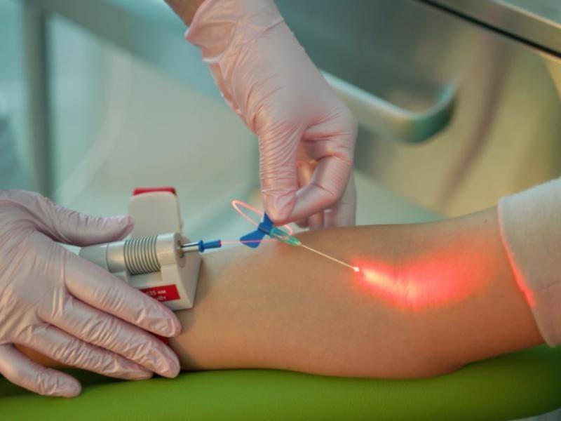 iv laser light therapy