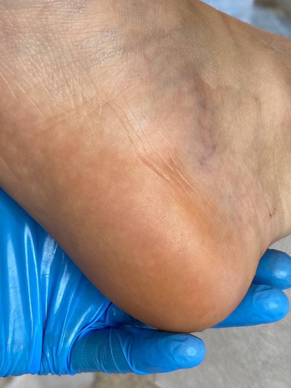 обработанные трещины