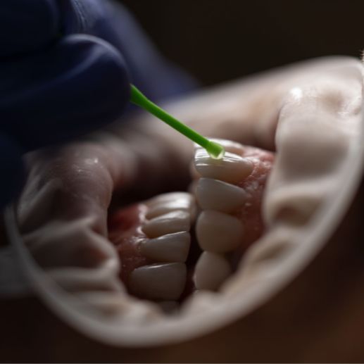 реставрация зубов дрожжино