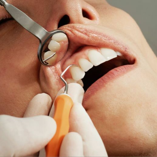 имплантация зубов и вредные привычки