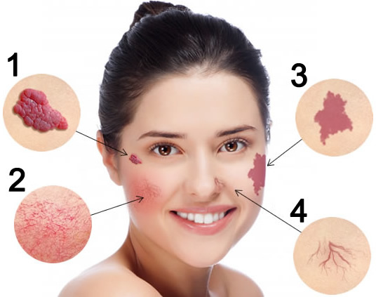 Какая процедура подойдет Вам? Клиника инновационных медицинских ...