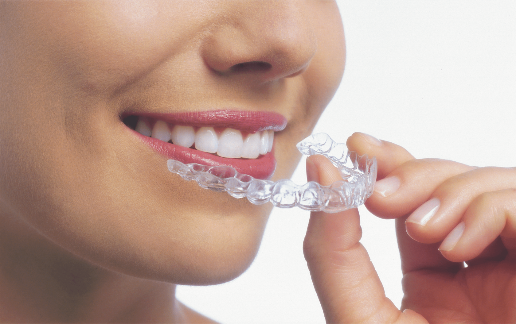 Элейнеры. Каппы Инвизилайн. Элайнеры Invisalign. Элайнеры ортодонтия. Ортодонтическая Капа элайнеры.