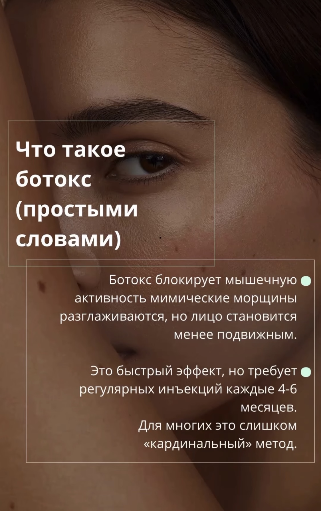 Что такое ботокс (простыми словами)?