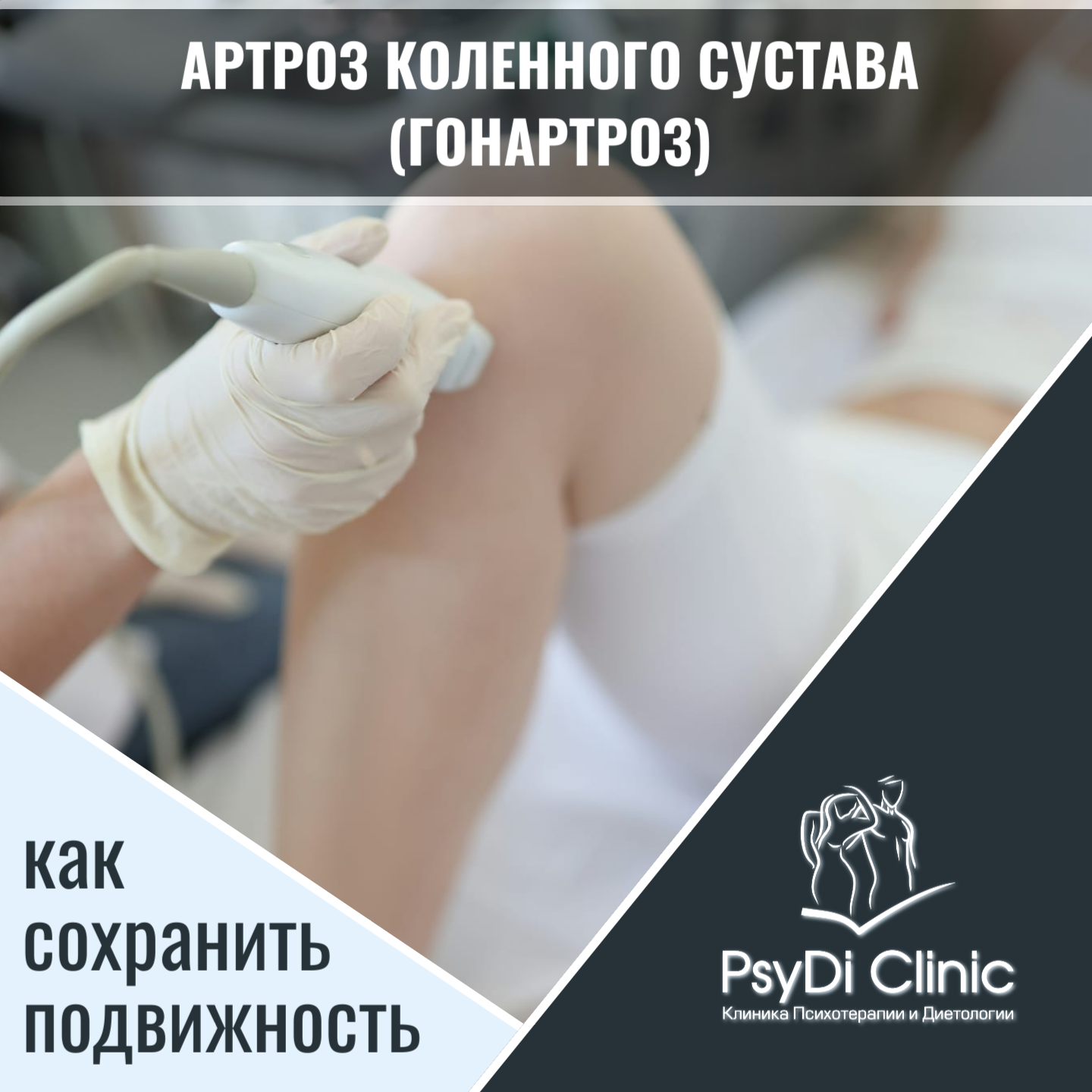 «Артроз коленного сустава (гонартроз): как сохранить подвижность» ��