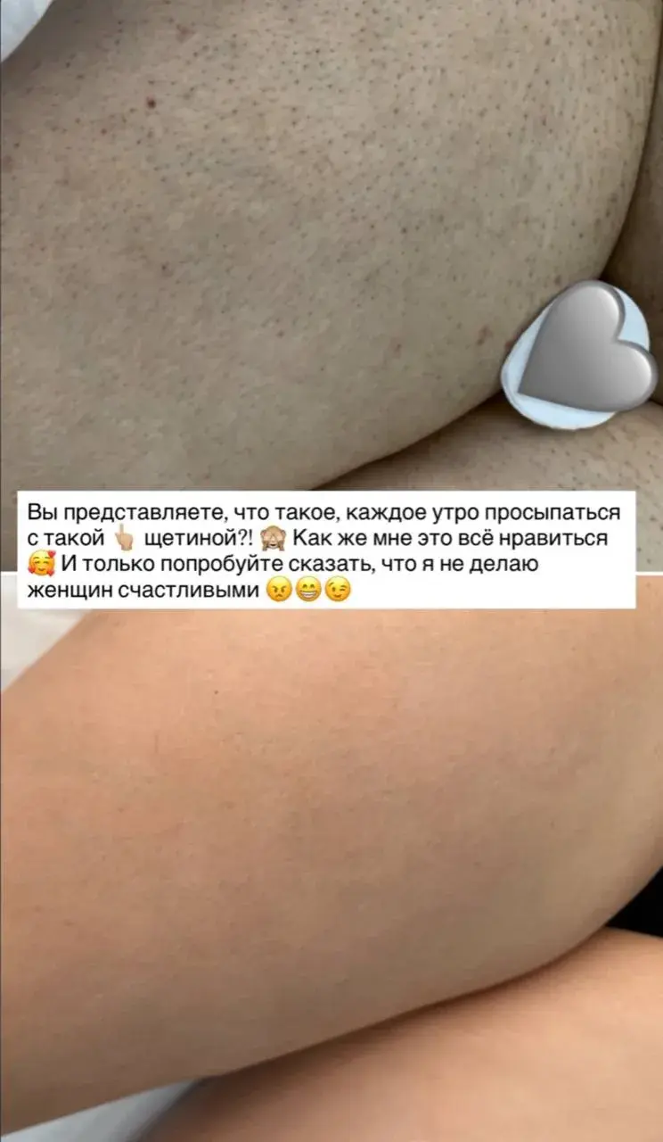 Гладкая кожа после процедуры