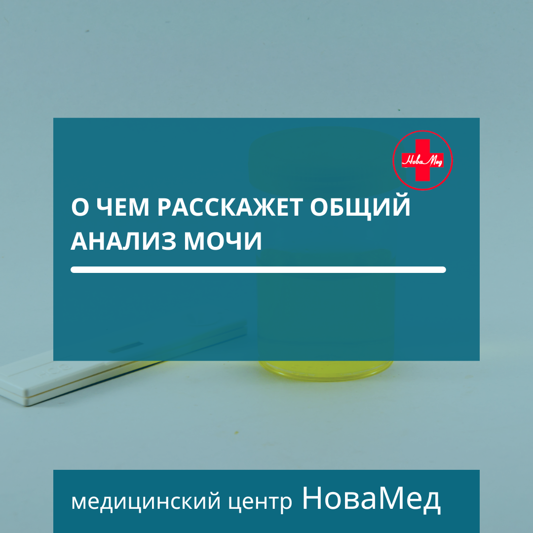 О чем расскажет общий анализ мочи