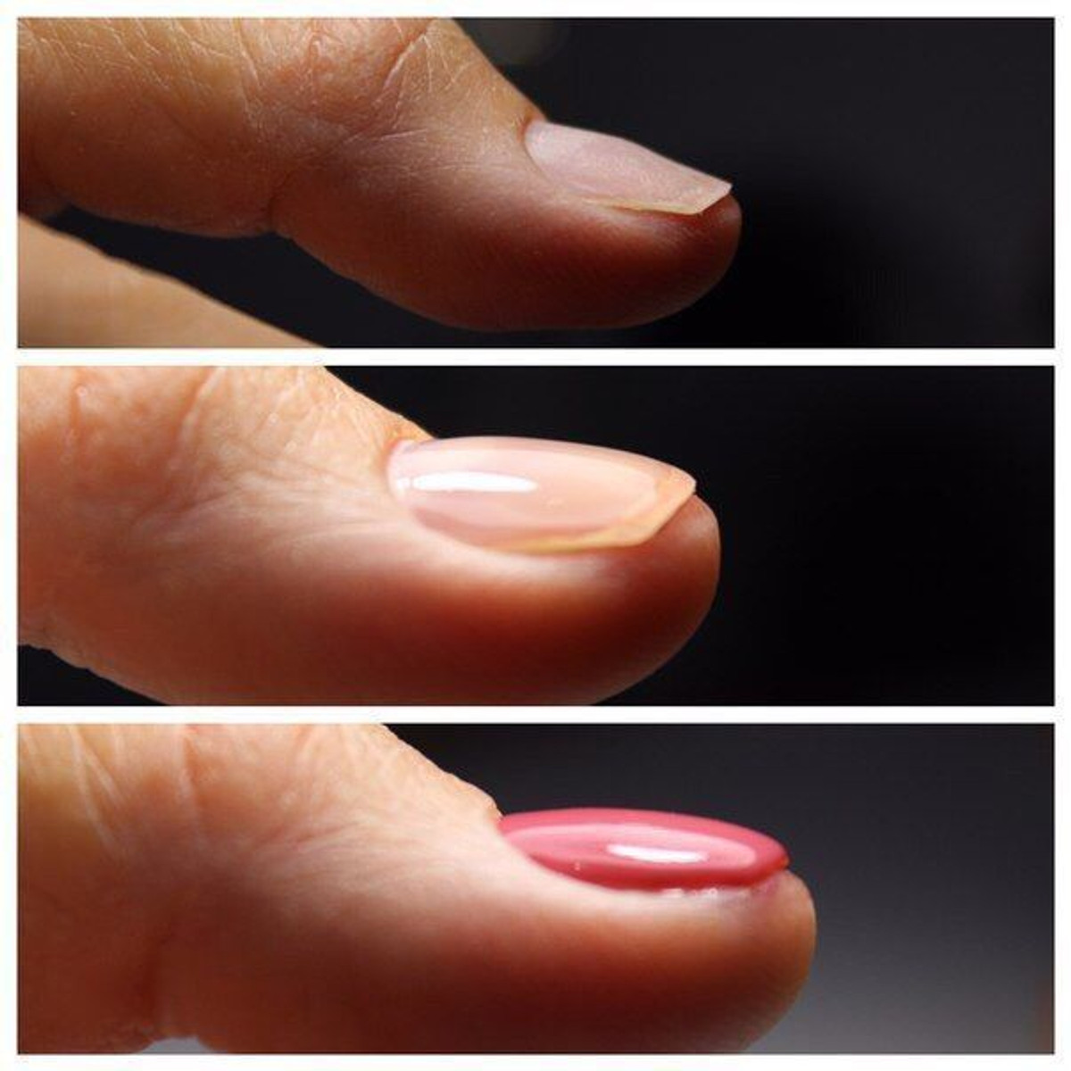 Апекс ногтевой пластины