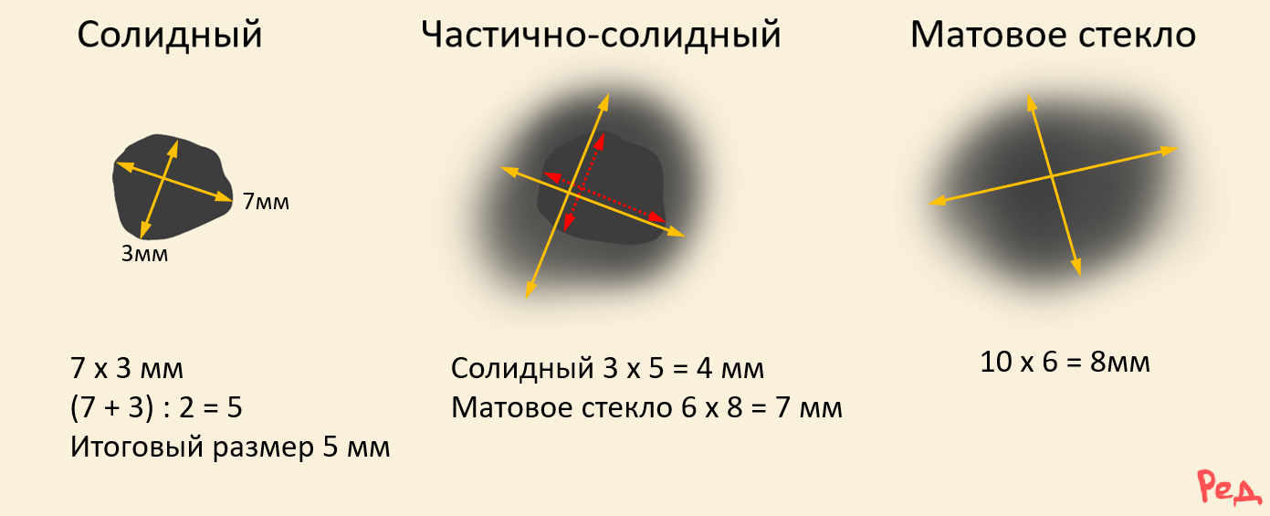 Методика измерения очага в лёгком на КТ
