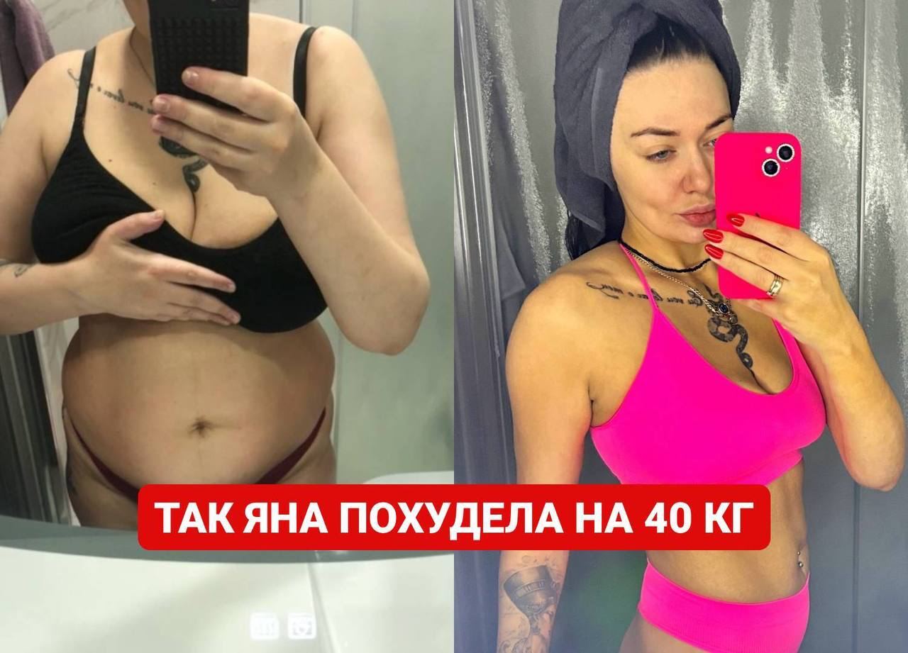 Яна — фото до и после