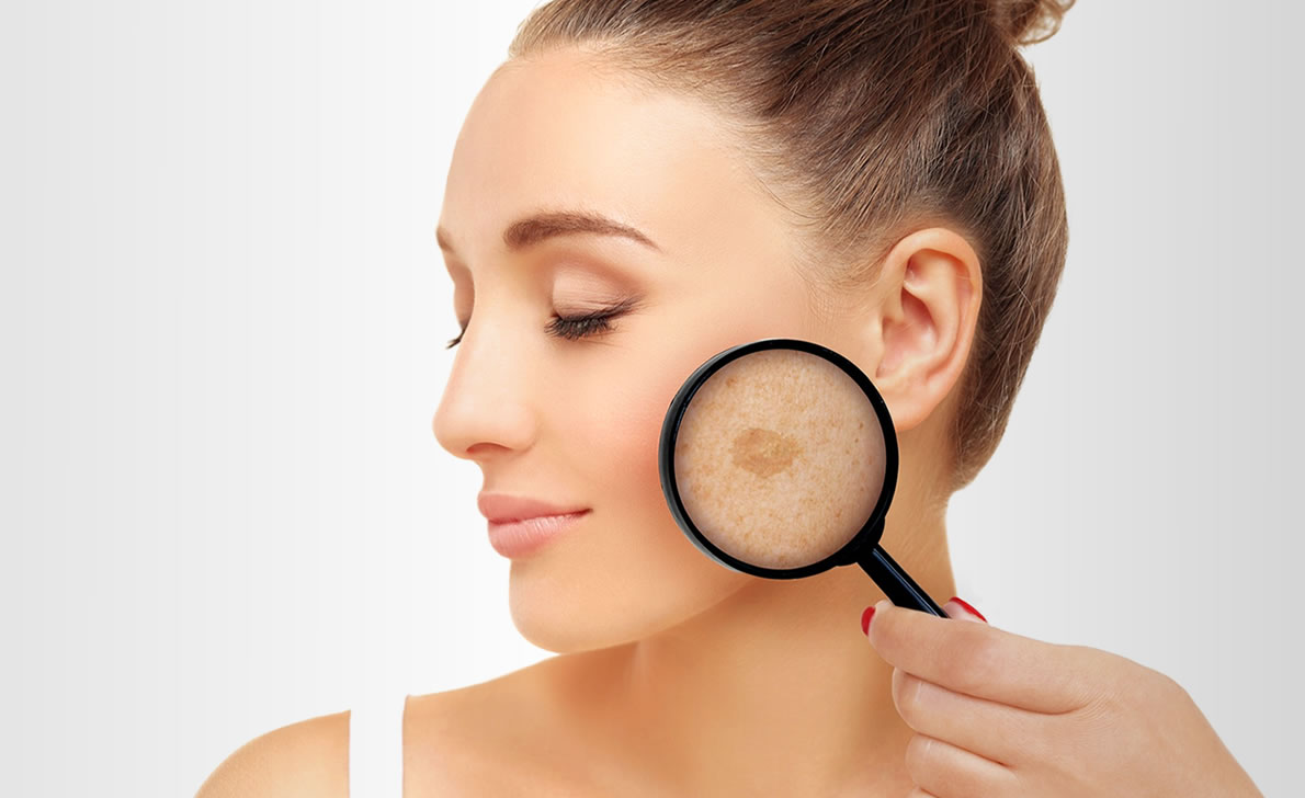 Удаление пигментных пятен и веснушек на лице лазером в клинике лазерной ...